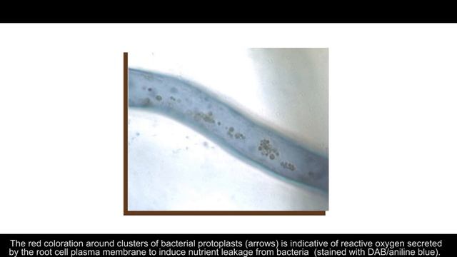 Rhizophagy Cycle and Nitrogen-Fixation by Endophytes in Plants смотреть онлайн
