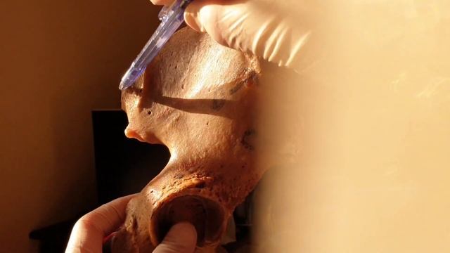 HIP BONE. features, side determination and anatomical position смотреть онлайн