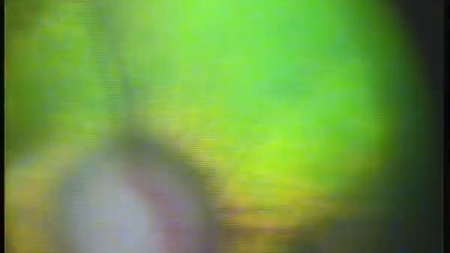 офтальмоскопия после постановки ИОЛ. Собака. смотреть онлайн