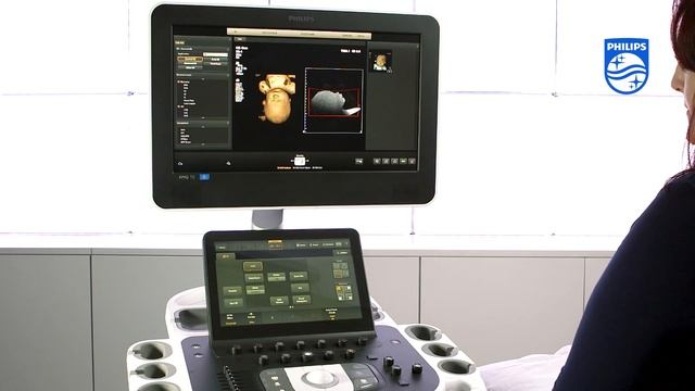 How to Perform a 4D Acquisition on a Philips EPIQ Ultrasound System смотреть онлайн