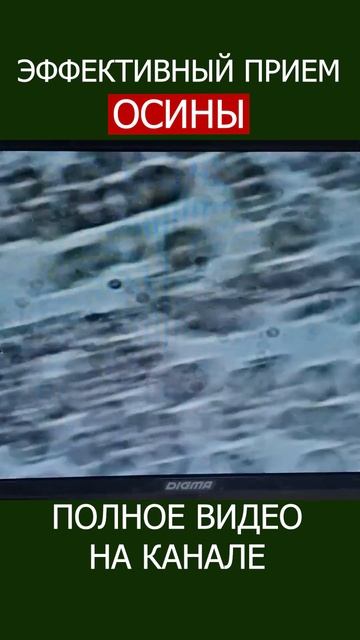 ОСИНА ОЧИЩАЕТ КРОВЬ НАТУРАЛЬНОЕ спасение от ПАРАЗИТОВ! #shotrs #осина #фитотерапия смотреть онлайн