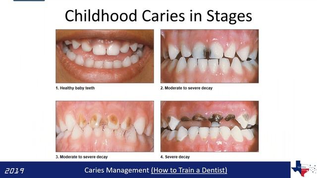 Dup15q Alliance Webinar Series Dental Care Dr Fray смотреть онлайн