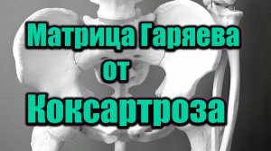 Матрица Гаряева от коксартроза | Восстановление тазобедренных суставов | Обезболивание