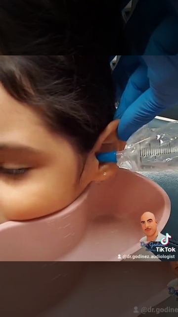Ear wax removal (Ear cleaning) смотреть онлайн