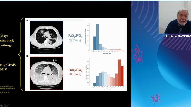 Should we intubate the happy hypoxic COVID-19 patient Pro Luciano Gattinoni 2021