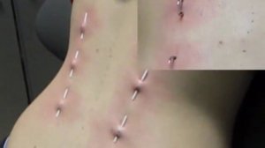 Corset Piercing by Tattooland (A).wmv