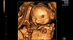 3-D УЗИ на 26 неделе беременности:) Первое "знакомство" с малышкой