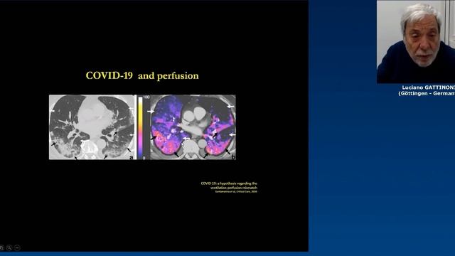 Mechanical ventilation and physiology on treated COVID patients Luciano Gattinoni 2021