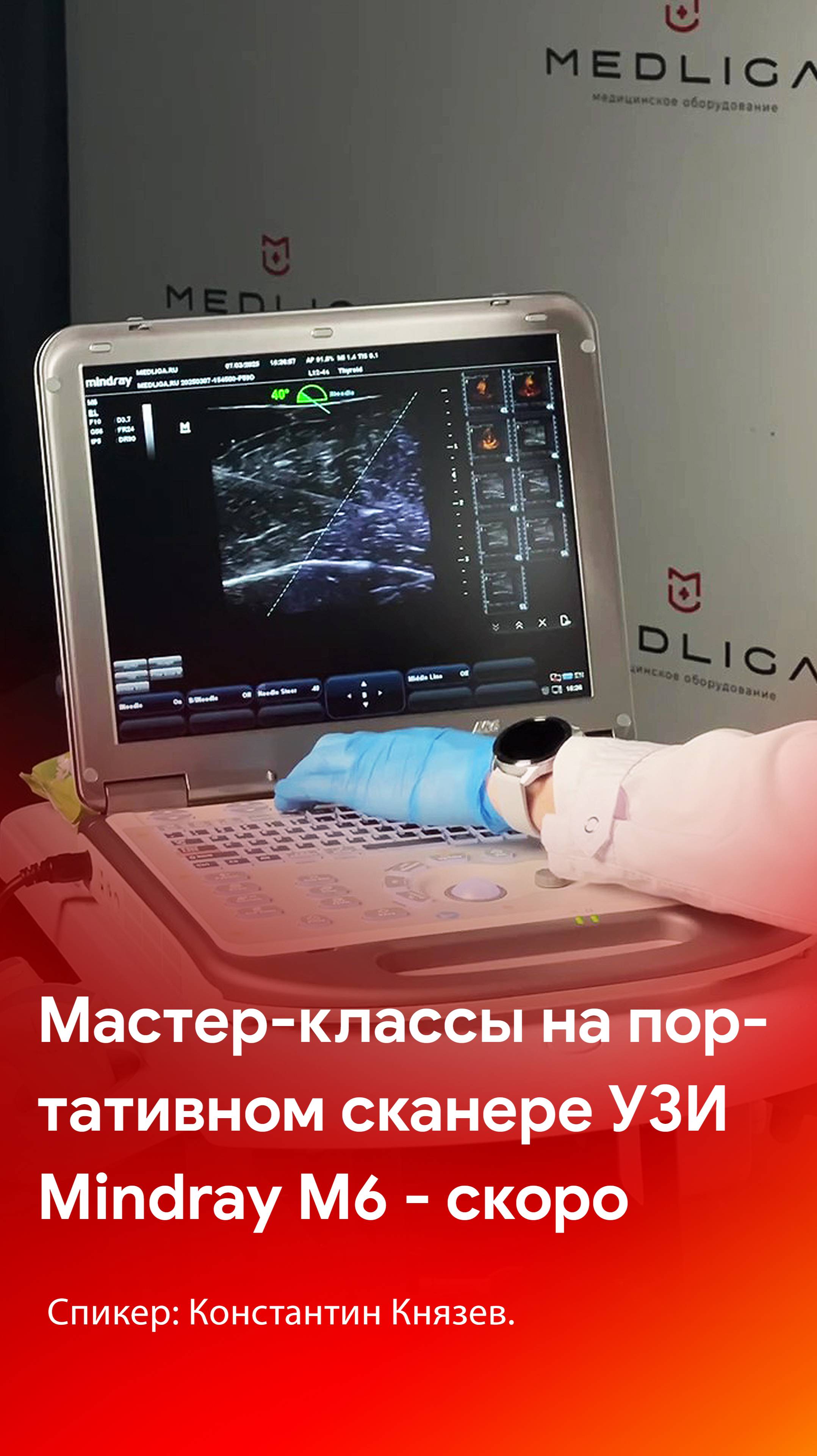 Мастер-классы на УЗ аппарате Mindray M6 - скоро смотреть онлайн