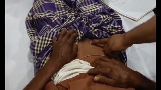 Inguinal Hernia || surgery short case || surgery смотреть онлайн