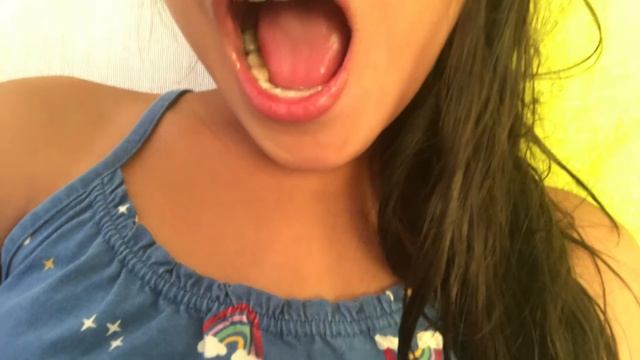 Braces смотреть онлайн