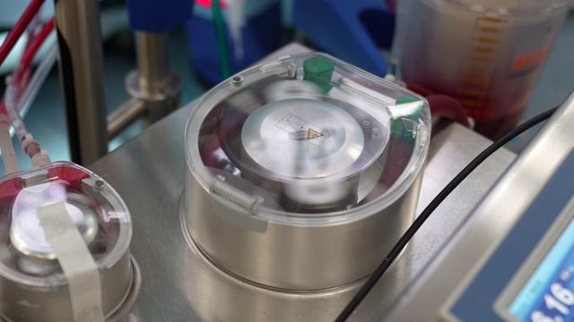 Комплексное хирургическое лечение тяжёлого сочетанного заболевания сердца и аорты. Отзыв пациента смотреть онлайн