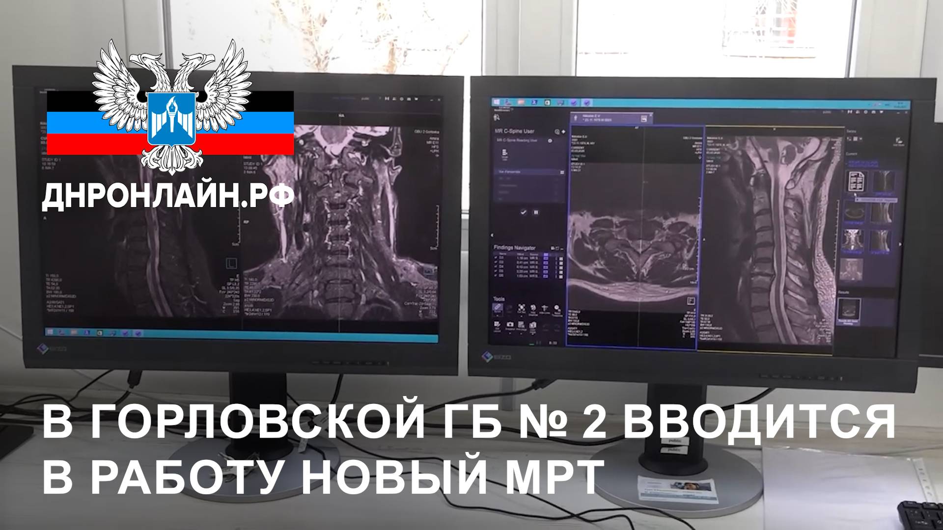 В горловской ГБ № 2 вводится в работу новый МРТ смотреть онлайн