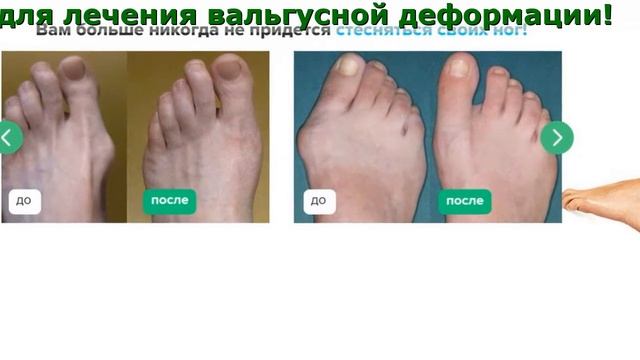 Магнетфикс Купить смотреть онлайн