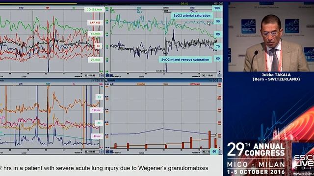 Sedation and the cardiovascular system Jukka Takala 2016