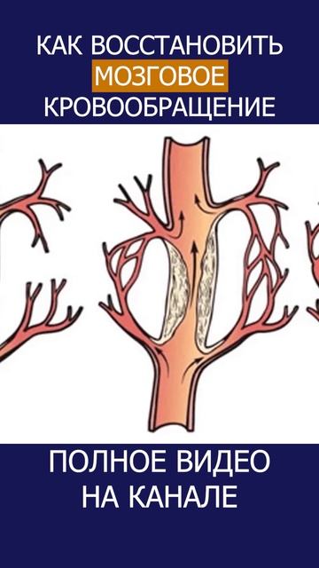СОСУДЫ МОЗГА и их ВАЖНОСТЬ что происходит, когда они ослабевают! #shotrs #сосуды #мозг смотреть онлайн