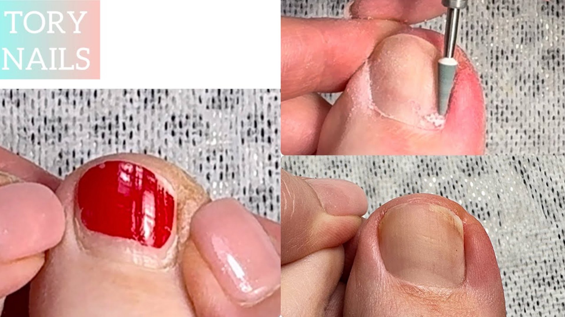 Педикюр 🌺 аппаратный педикюр 🌿 обработка пальцев 🌸 педикюр себе