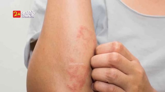 Kovakkai Health Benefits In Tamil - Ivy Gourd