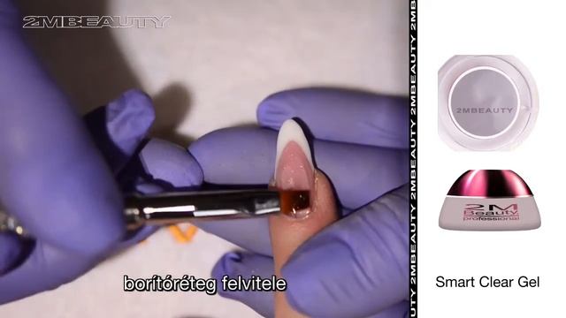 Smart Gel смотреть онлайн