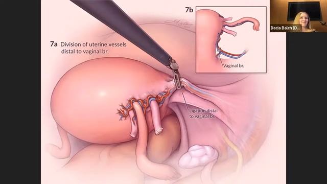 Surgical Illustration Presentations - MBI 2022 смотреть онлайн