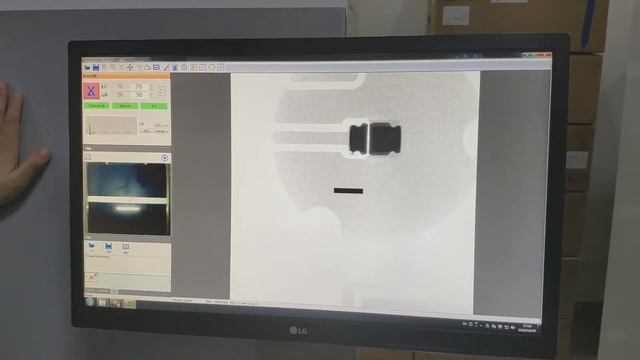 X-Ray Inspection-Automatic Defects Output and Report смотреть онлайн