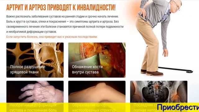 Хондрексил Купить Тольятти смотреть онлайн