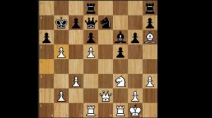 Магнус против защиты Пирца - Уфимцева.