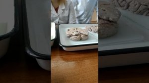 Горизонтальный разрез головного мозга. Белое вещество больших полушарий головного мозга.