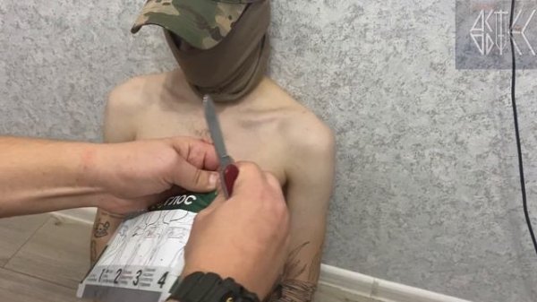 Окклюзионный пластырь ГЕПОГЛОС. Я такого не ожидал.