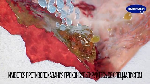 Доверьте уход за раной гидроактивной повязке HydroClean® Plus