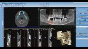 Romexis 3D как пользоваться программой