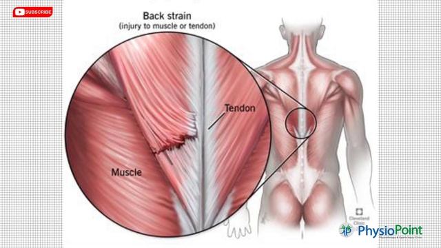 Top 3 Causes of Back Pain in Hindi - कमर दर्द किस कारणों से होता है | Dr. Sunil Tank смотреть онлайн
