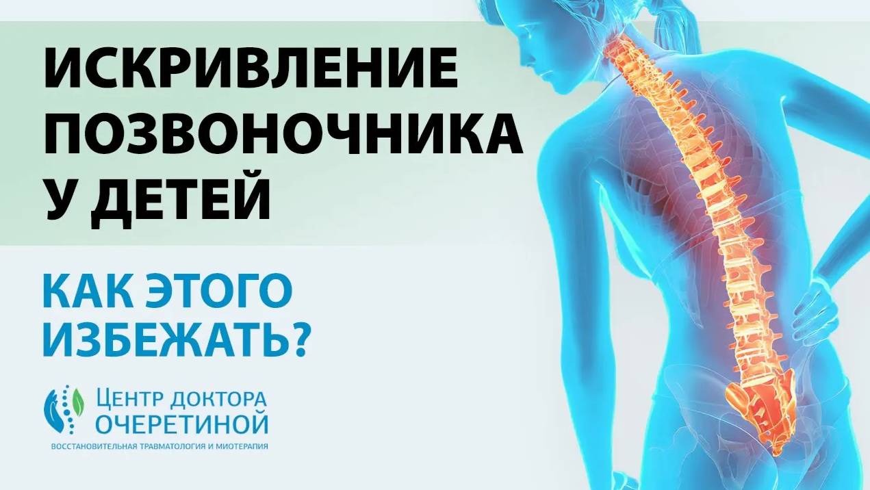 Как ИЗБЕЖАТЬ появления СКОЛИОЗА у РЕБЕНКА? смотреть онлайн