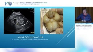 Возможности посмертной патологоанатомической верификации пороков развития, выявленных внутриутробно