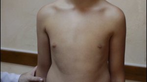 Определение границ сердца