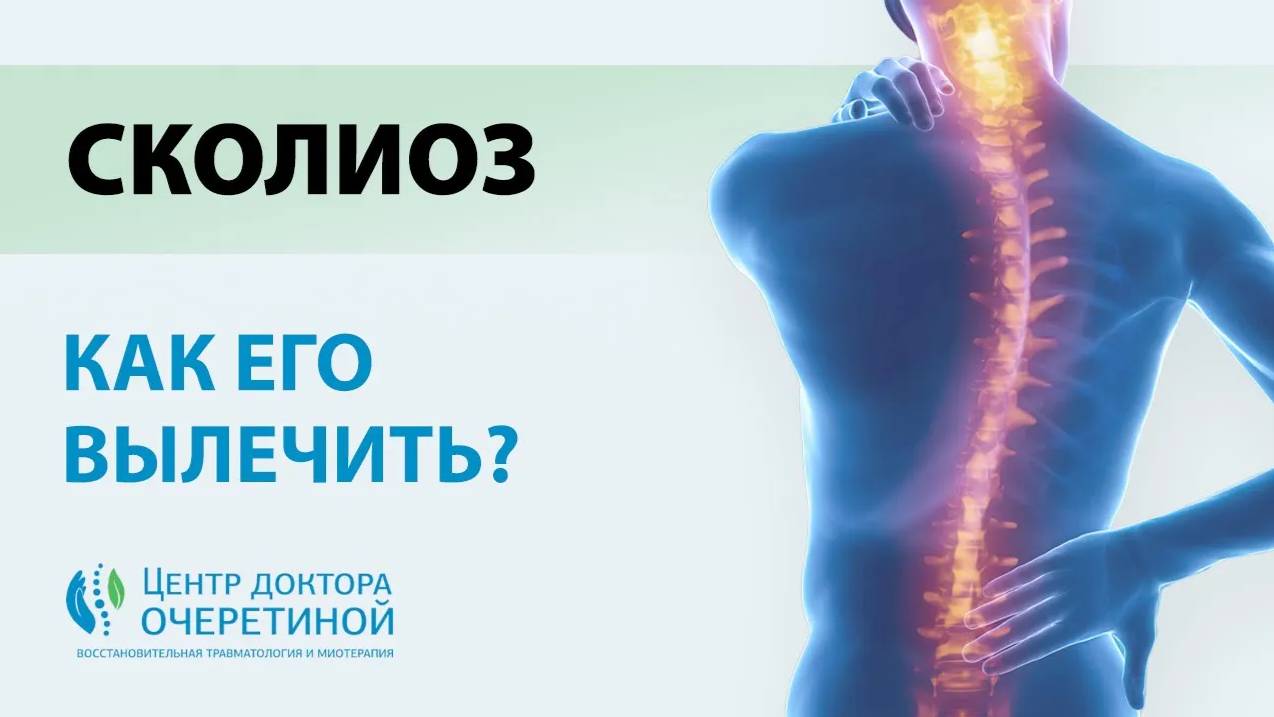 Как БЫСТРО вылечить СКОЛИОЗ? | Топ УПРАЖНЕНИЙ для ЛЕЧЕНИЯ СКОЛИОЗА смотреть онлайн