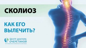 Как БЫСТРО вылечить СКОЛИОЗ? | Топ УПРАЖНЕНИЙ для ЛЕЧЕНИЯ СКОЛИОЗА