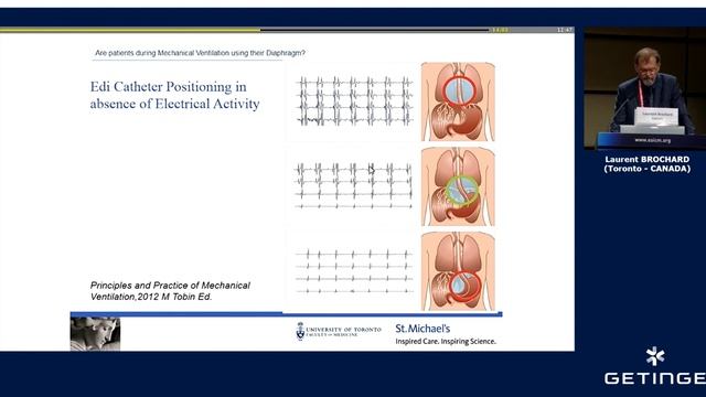The role of the Edi signal for intensive care patients from admission to discharge Laurent Brochard