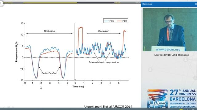 How to measure TPP Temptations and pitfalls Laurent Brochard 2014