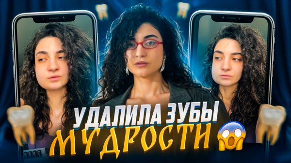 УДАЛИЛА ДВА ЗУБА МУДРОСТИ // СКОЛЬКО ЭТО СТОИЛО И КАК Я ПЕРЕНЕСЛА ПРОЦЕДУРУ