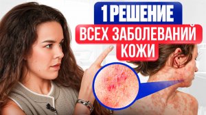 Дерматит, экзема, псориаз = 1 простое лечение (1 решение всех заболеваний кожи)