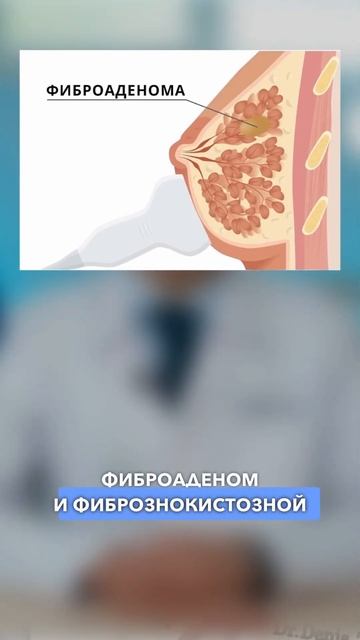 Гормональные контрацептивы могут быть опасны для жизни! #медицина #гинекология смотреть онлайн