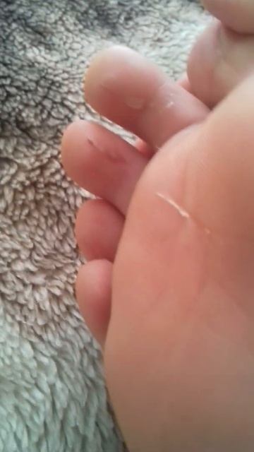 кот поцарапал