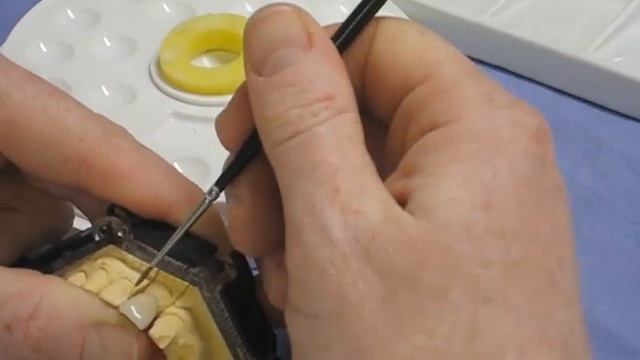 Restoring a tooth: Ceramic Glaze and Stain смотреть онлайн