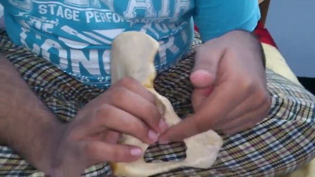 hip bone acetabulum смотреть онлайн