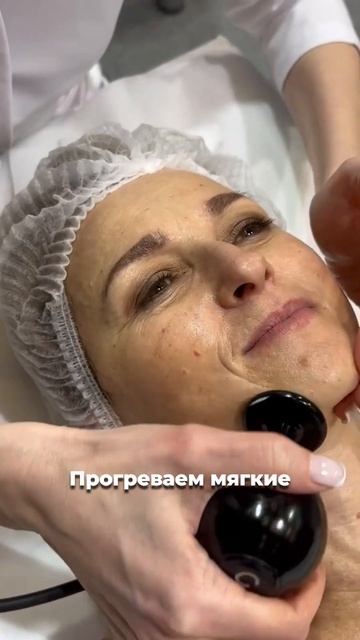 Омоложение и лифтинг кожи #косметология #реабилитация #winback смотреть онлайн