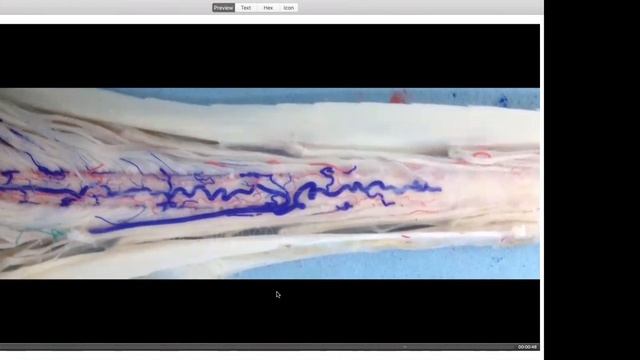 Victor Hugo Perez Perez Neuroanatomist On The Sudan Channel