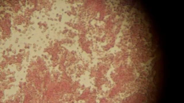 Dirofilaria смотреть онлайн