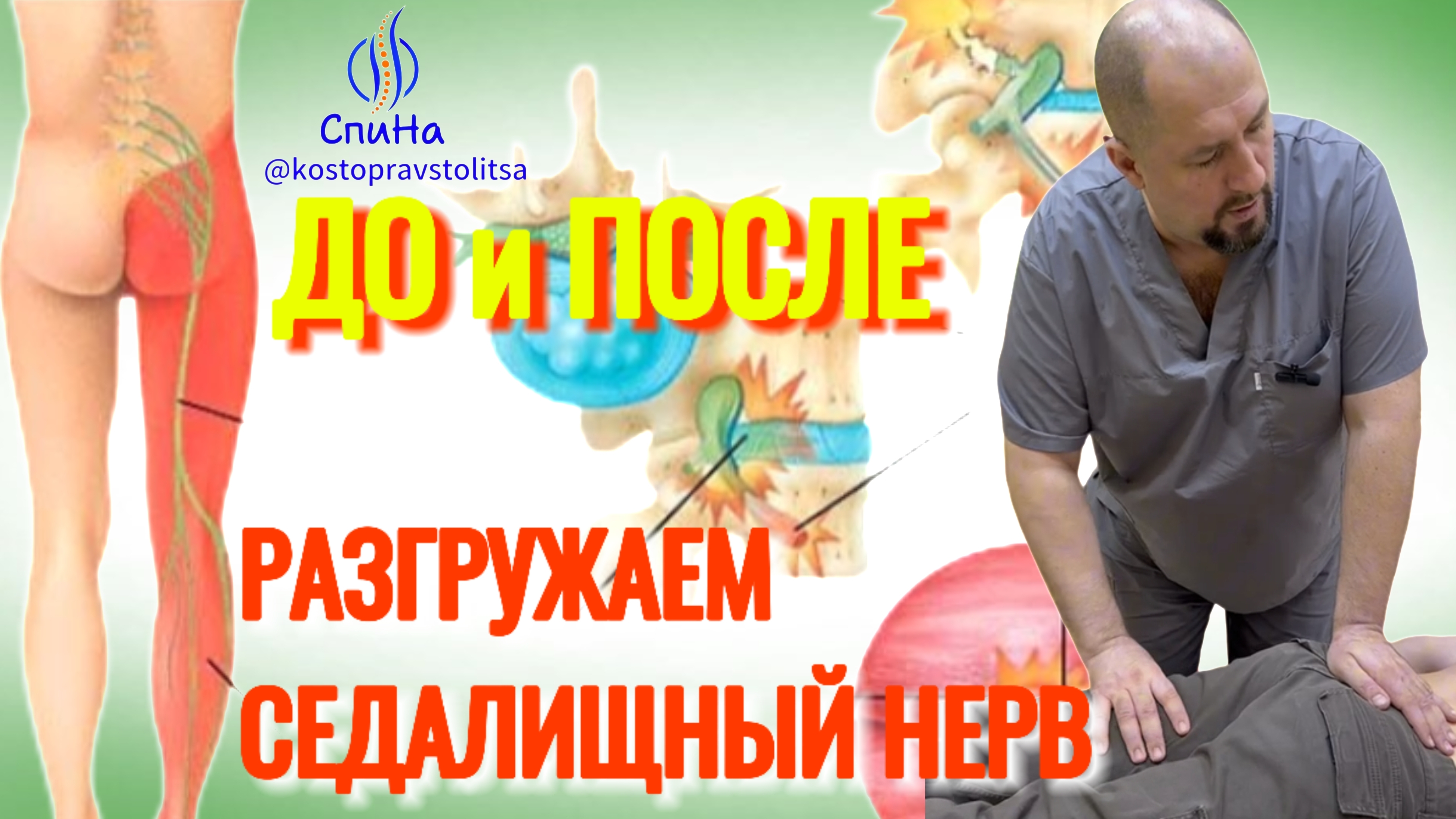 Работаем с седалищным. Разблокировка #костоправмосква #здоровьеспины #седалищныйнерв смотреть онлайн