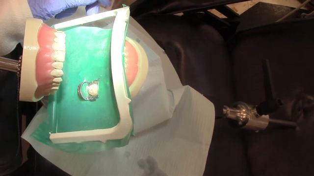 Root Canal Procedure